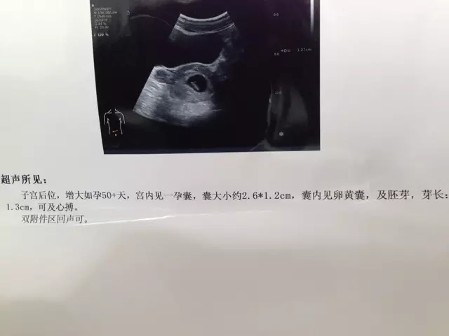 3、刚怀孕怎么知道男女妙招:怀孕想知道男女有几种方法？