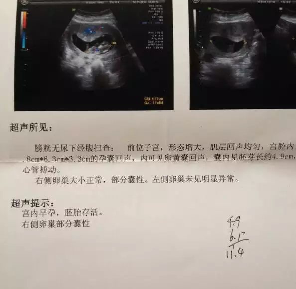 2、怀孕怎么看男女准确率高:生男生女怎么算准确性高