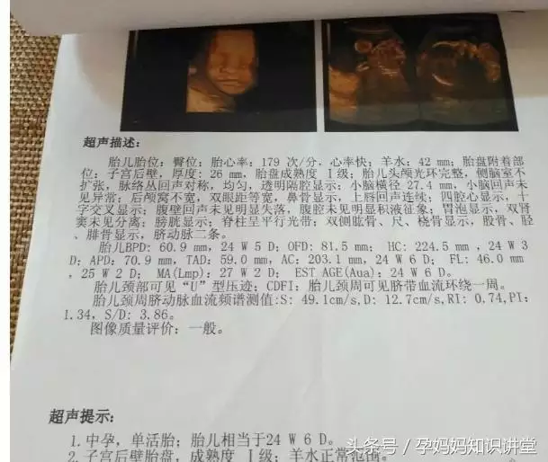 2、5种能看出怀或女宝:怎么判断自己怀的是男孩还是女孩?