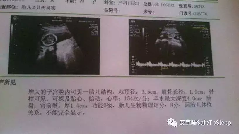 1、输入怀孕月份算男女:生男生女是命中注定的吗