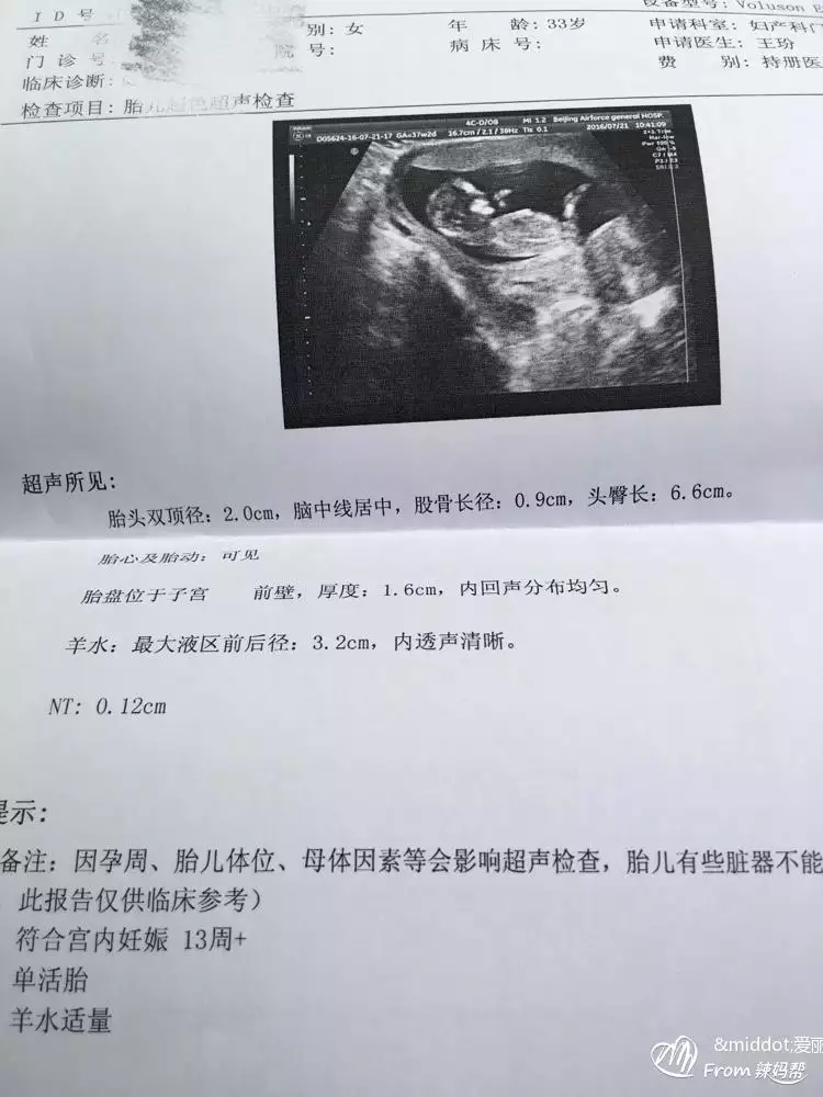 1、有没有比较准确的测试男女的方法:什么方法测男女最准确的