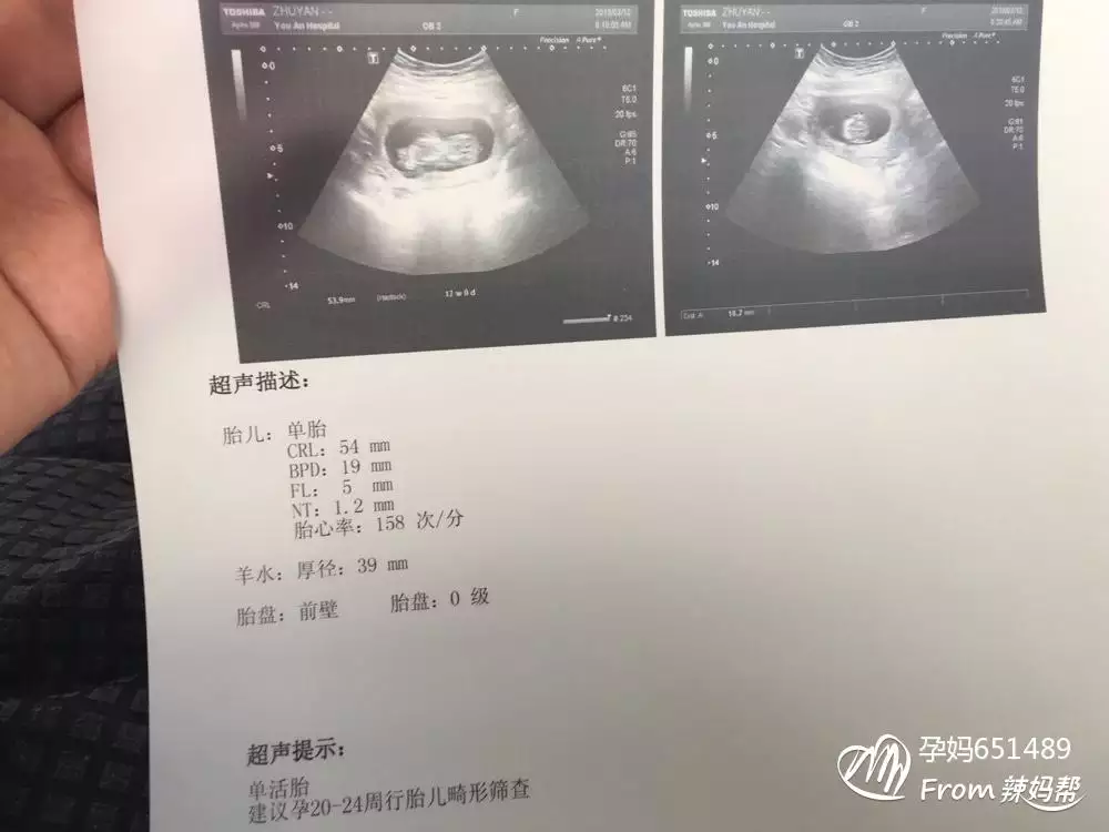 2、怀孕多久可以看出来是男孩女孩:八周验血是男孩,四个月做bc说是女孩.我该信哪个