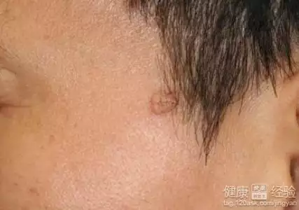 1、女人身上有的表现:你见过身上有和的人吗？