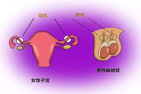 1、男人绝育的好处与坏处:公狗做绝育有哪些好处和坏处