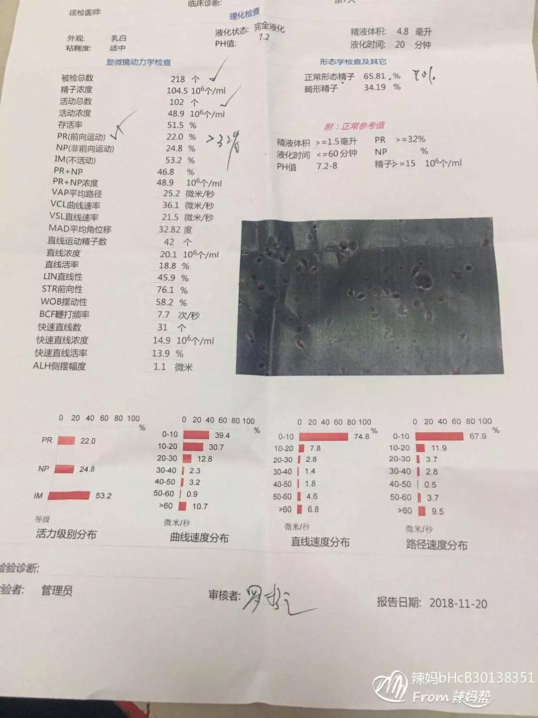 1、备孕男孩成功经验是什么样子的啊？大家告诉我下吧，我想生个男孩的。