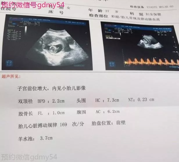 3、怀孕怎么看男女准确率高:怀孕想知道男女有几种方法？