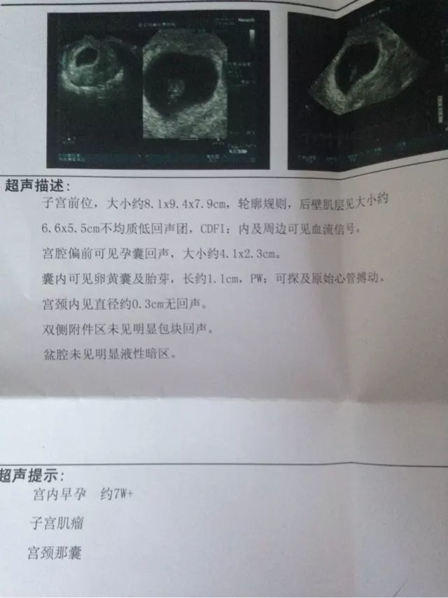 3、b超孕囊2个数看性别:为什么有的孕囊是圆的，有的是茄子形的