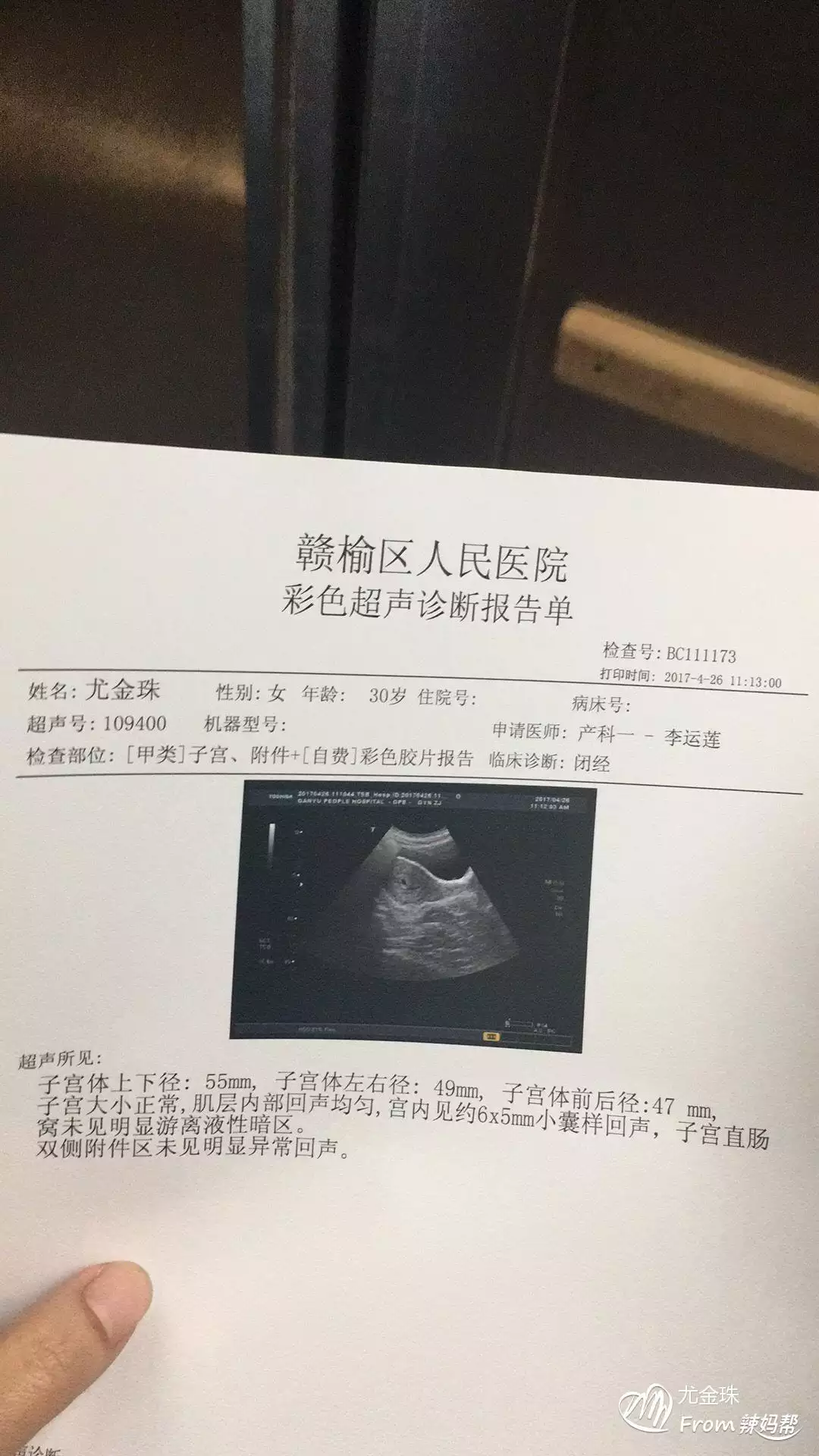 2、刚怀孕怎么知道多少天了:生女儿的征兆