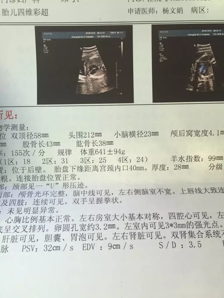 5、彩超单上怎么看出X和Y:图中x和y具体是什么意思？