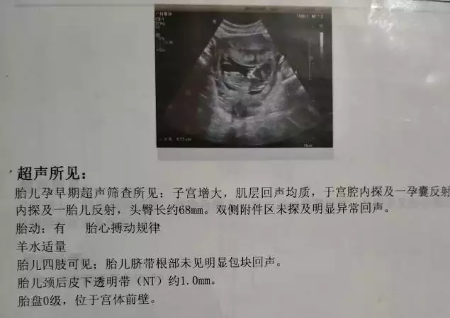 3、什么时间生男孩:什么时候容易生男孩子，有这个说法的吗？可以怎么调理呢？