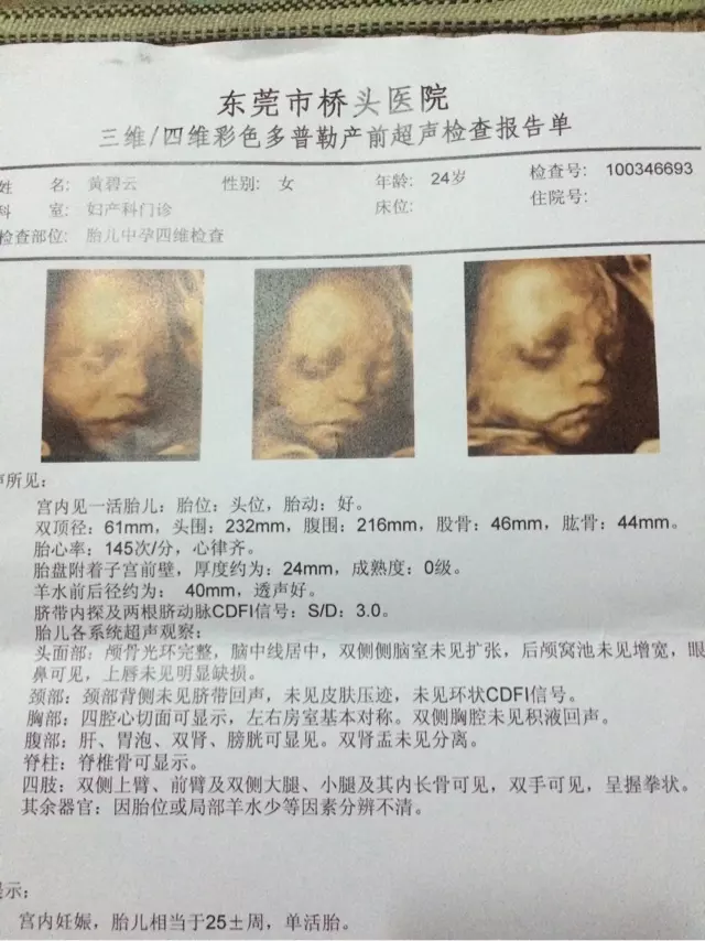 1、免费测生女宝:怎么分辨生男孩女孩