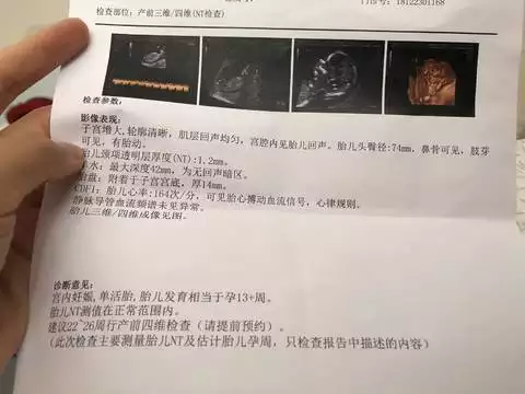 5、怀孕期间怎么鉴定孩子是谁的:怀孕四周，怎么确定孩子是谁的？