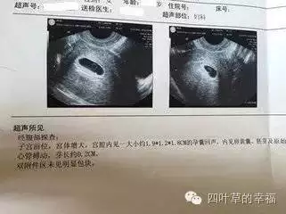 3、怀孕45天抽血查准吗:什么是母体血液Y基因筛查