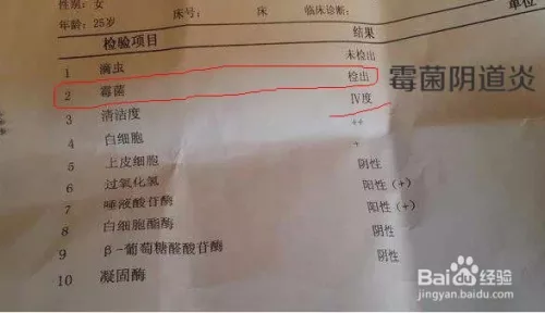 3、和老公就复发霉菌:为什么霉菌性炎总是复发，反反复复的好烦人