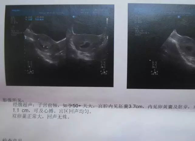 1、正常情况下一次大概几分钟:男生正常一次是几分钟