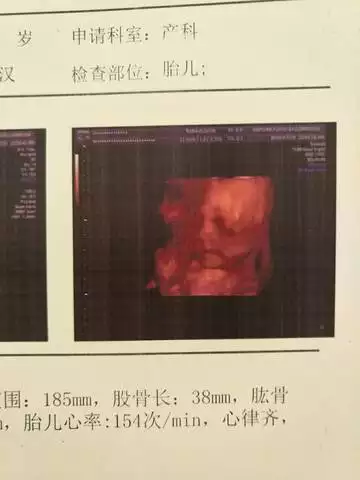 1、最科学的怀男孩方法带酸性:目前有什么办法确保一定生男孩？怎样做容易生儿子？