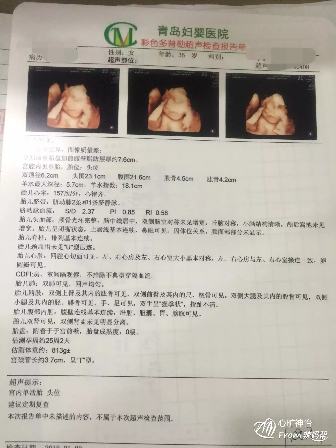 2、请问大家想生男孩的科学方法有哪些呢？怎么怀男孩？要提高生男孩的概率行不？