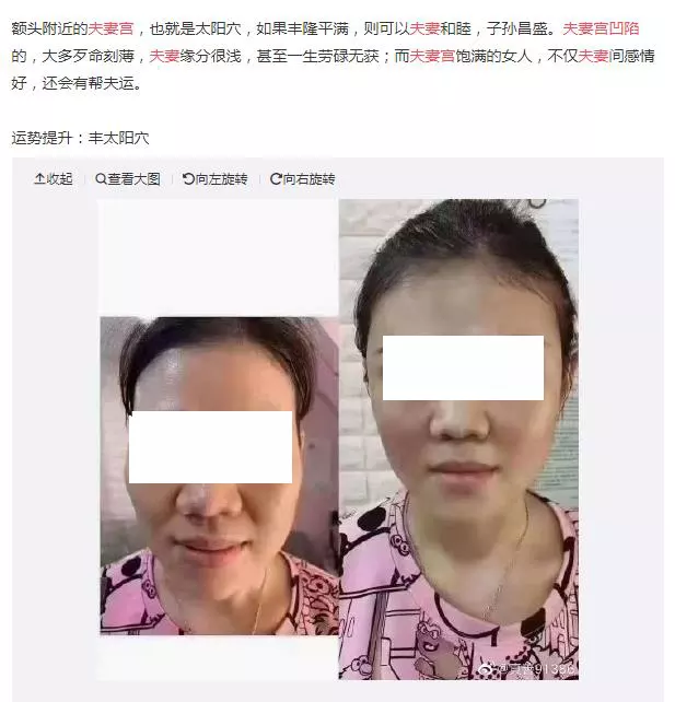 5、夫妻宫凹陷晚婚很幸福:夫妻宫凹陷是不是一辈子感情不好