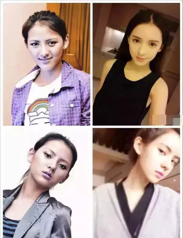 4、女人露额头和财运有没有关系:哪些痣是代表财运的不能点，哪些不点会影响运气？