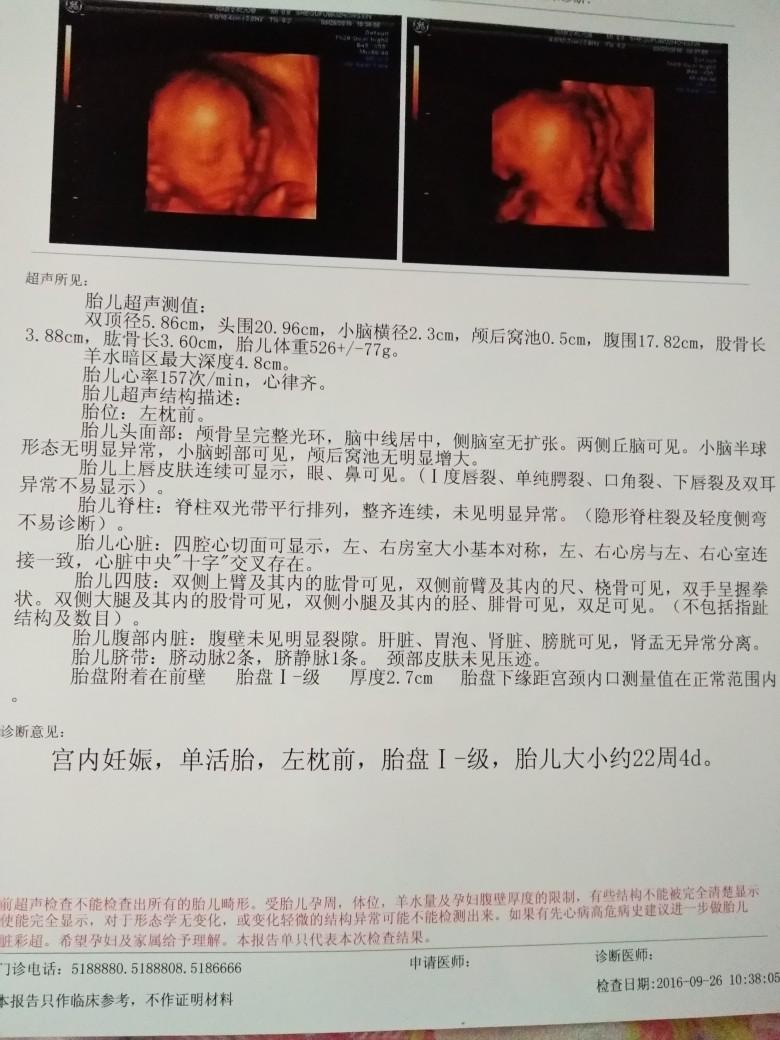 5、已生的四维彩超单子:怎么从四维检查单看出是男孩还是女孩