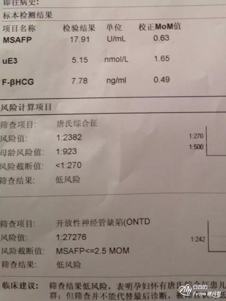 5、无创DNA检测结果18高于13合21是还是女宝