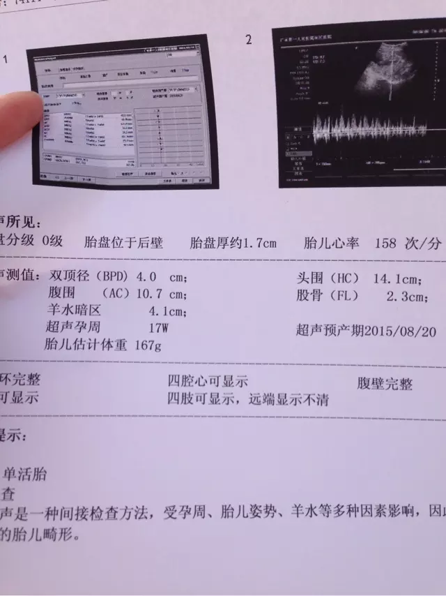 3、输入末次月经推算男女:末次月经算法？