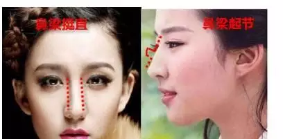 4、女人鼻梁有节千万不要娶:鼻梁有节容易离婚？大家怎么看？有实际的例子吗？