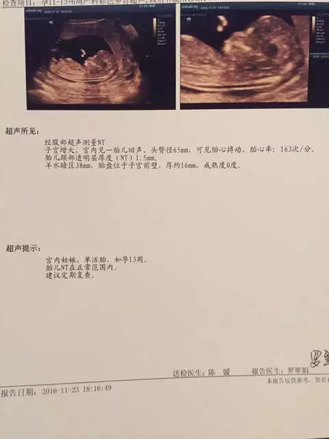 6、nt单可看男女准确率90:nt能看出男女吗