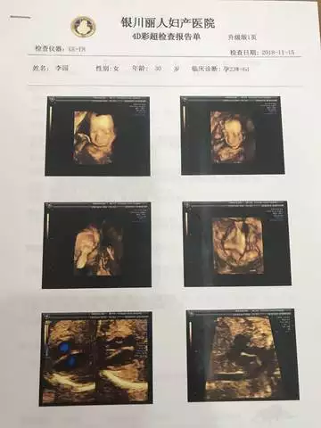 3、四维单子3秒钟看男是女:刚拍得四维，怎么看男女啊？