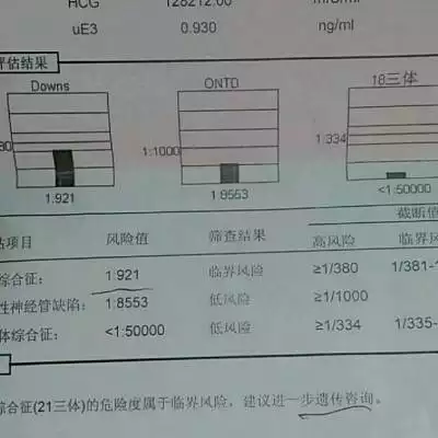 4、21,18,13三体看男女公式:21、18、13三体及数目表示什么意思？