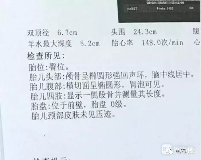 2、怎么看怀男孩和女孩呢？人家说看b超单子就能看出来，真的假的。