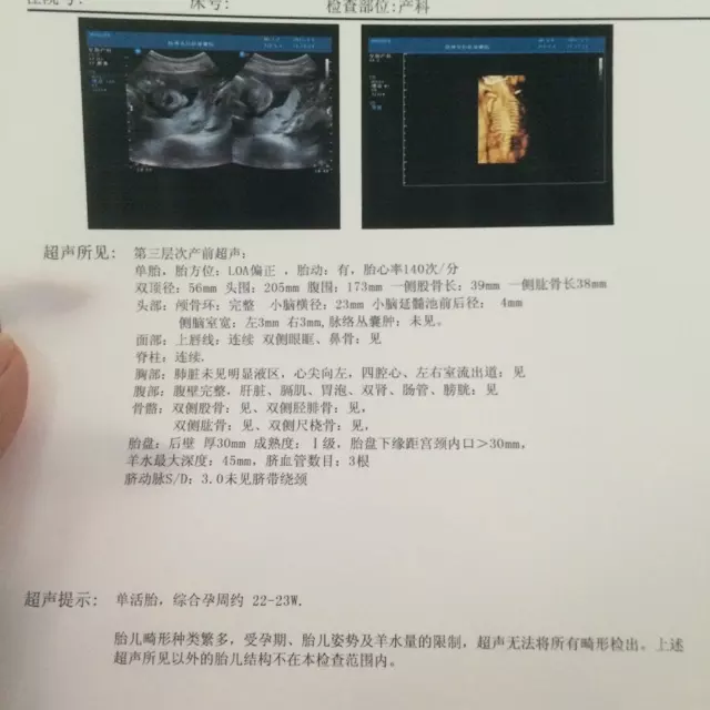 7、四维3个亮点是男孩:五个月四维彩超看有亮点是男是女