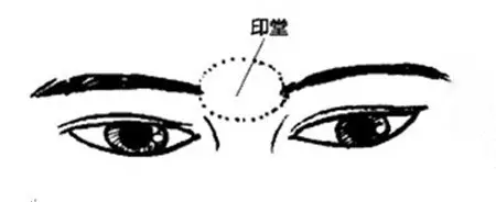 1、印堂有的:天庭到印堂有竖线是什么意思