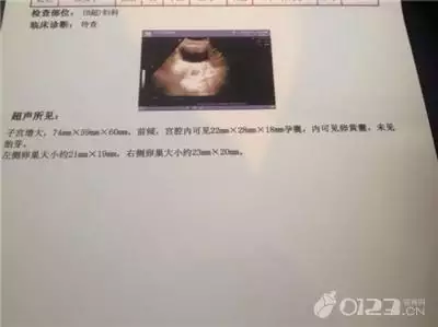 生男生女b超单上有暗示孕早期：怎么判断怀的是男孩还是女孩最准