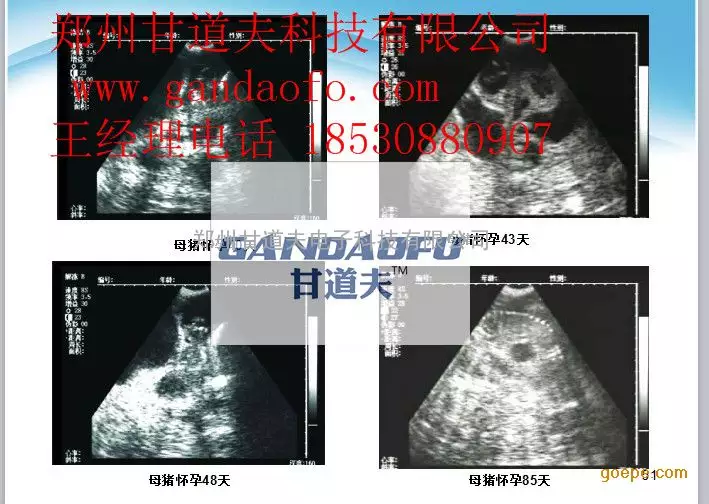 请教B超图片，这三张图说的什么？是什么部位？怎么...