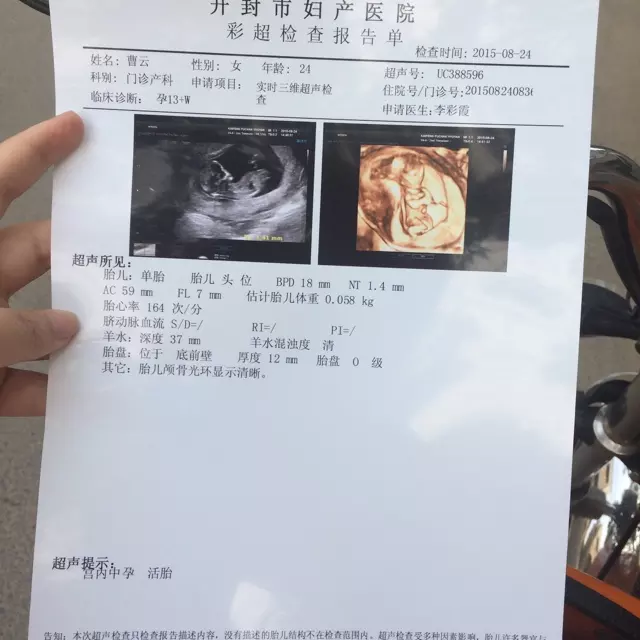 四维无明显分离是女宝吗：谁帮我看看四维彩超，是还是女宝