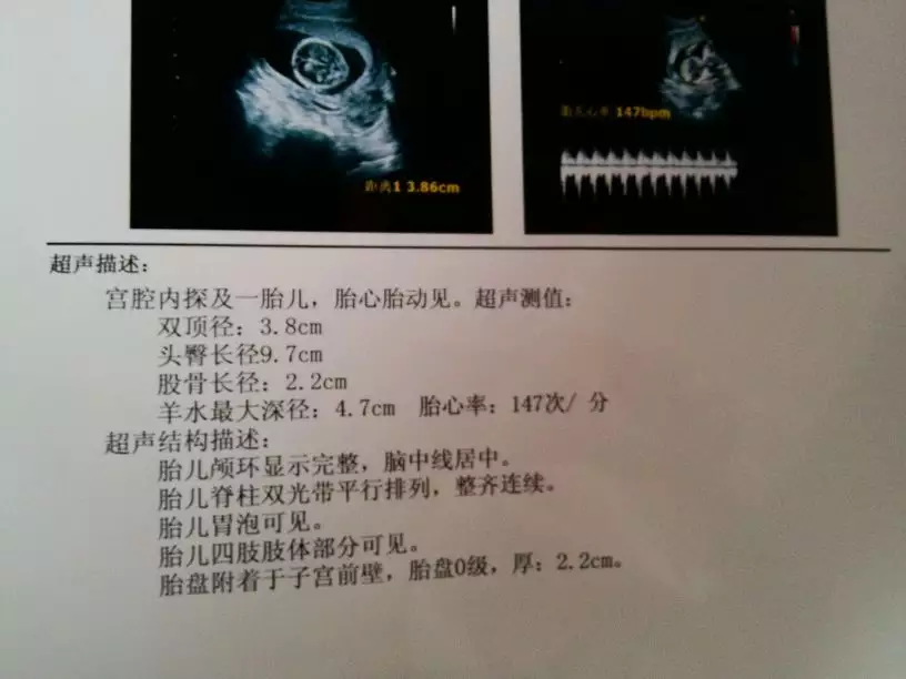 怀孕多少天能查出男女：算命准,还是bc准,一个说怀儿子,bc是女儿