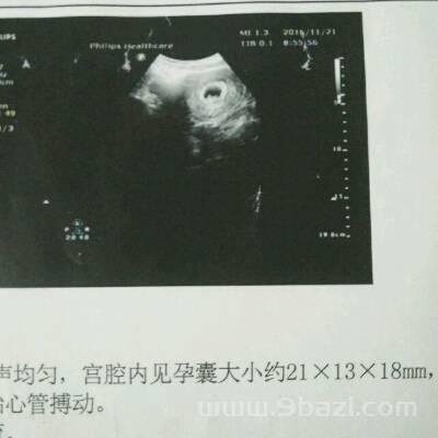 请问大家怀孕40天，孕囊看起来像圆的还是长的呢，能看出怀的男女吗