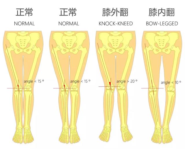 新鞋脚踝磨脚是因为外八字