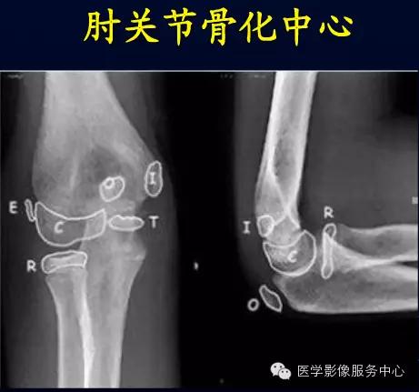 八字透视老公模样