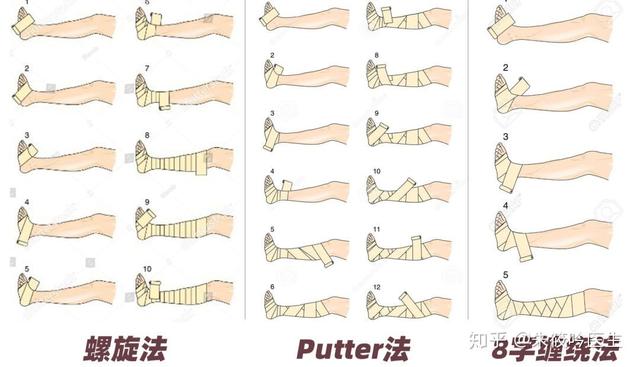 脚踝八字绷带固定法视频