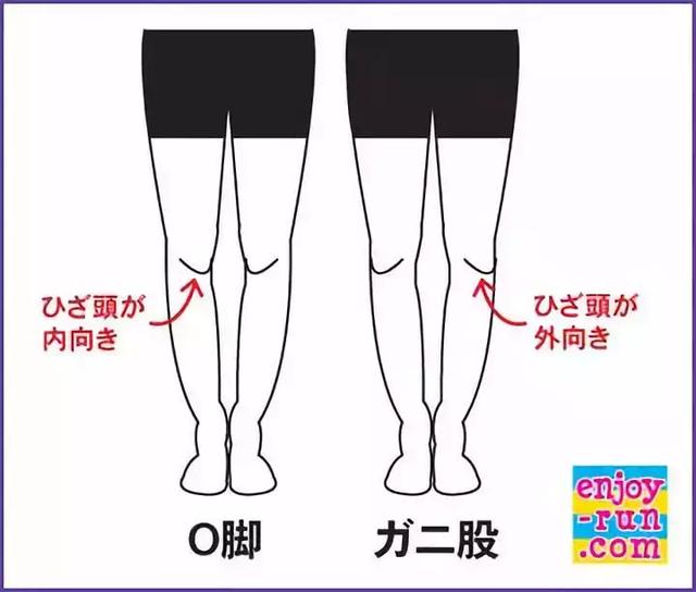 为什么日本女人都是里八字腿