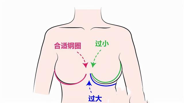 内衣八字扣是金属吗