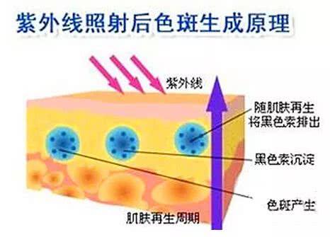 打肉毒素在额头八字纹