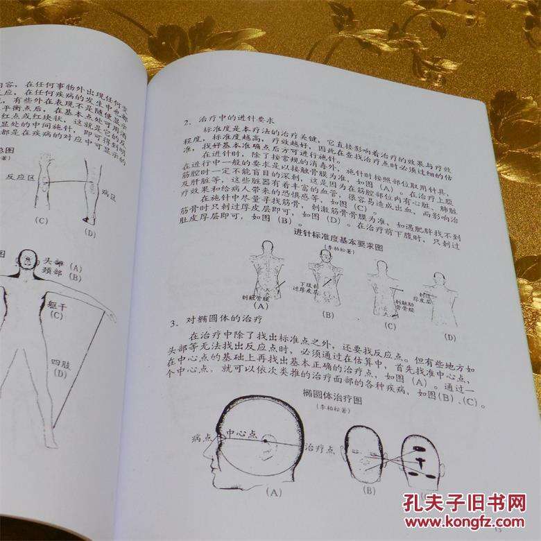 包含张文字八字针治疗中风后遗症图书的词条