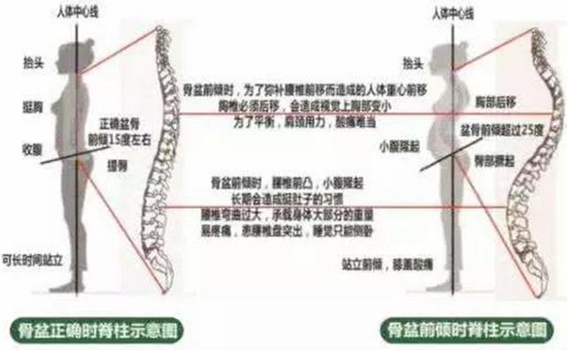 八字绑带过紧会导致骨生长恢复慢