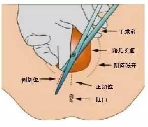 女人结婚后走路是八字吗