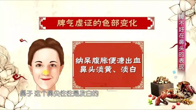 鼻翼两侧发白八字状怎么办