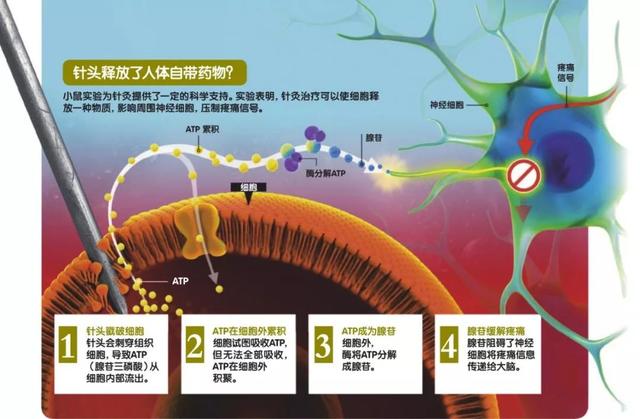 八字针灸疗法靠谱吗