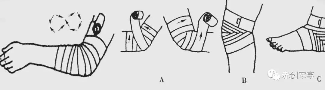 手臂绷带八字包扎法